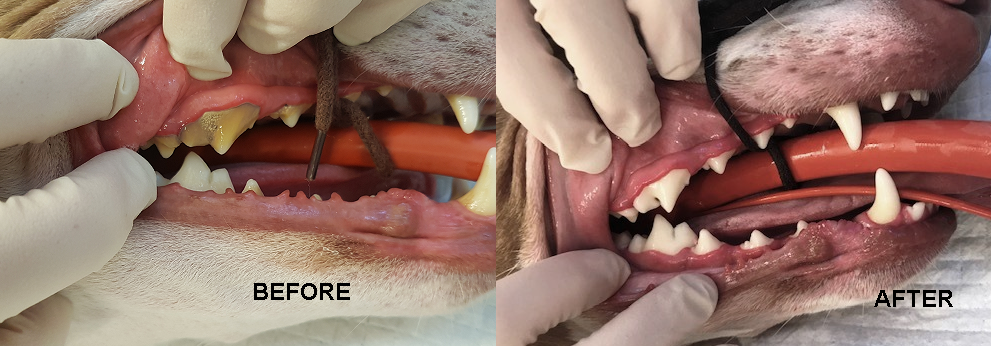 Calculus before and after treatment